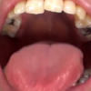 横山夏希の口内・銀歯・ベロ唾液全て見せます。 フェチ映像屋